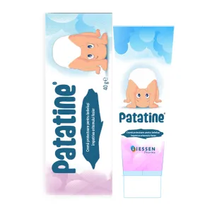 Patatine
